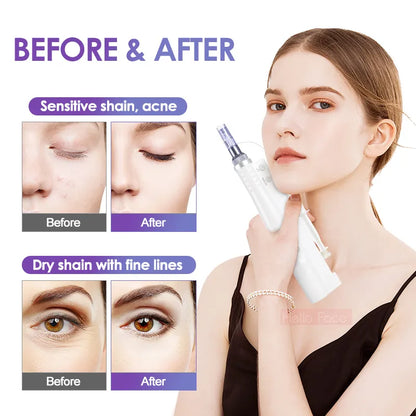 Mesotherapy Machine Hydra Whitening Injector